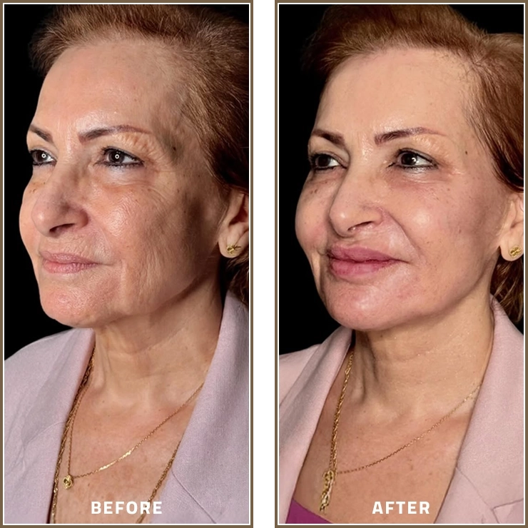 Full Face Enhancement